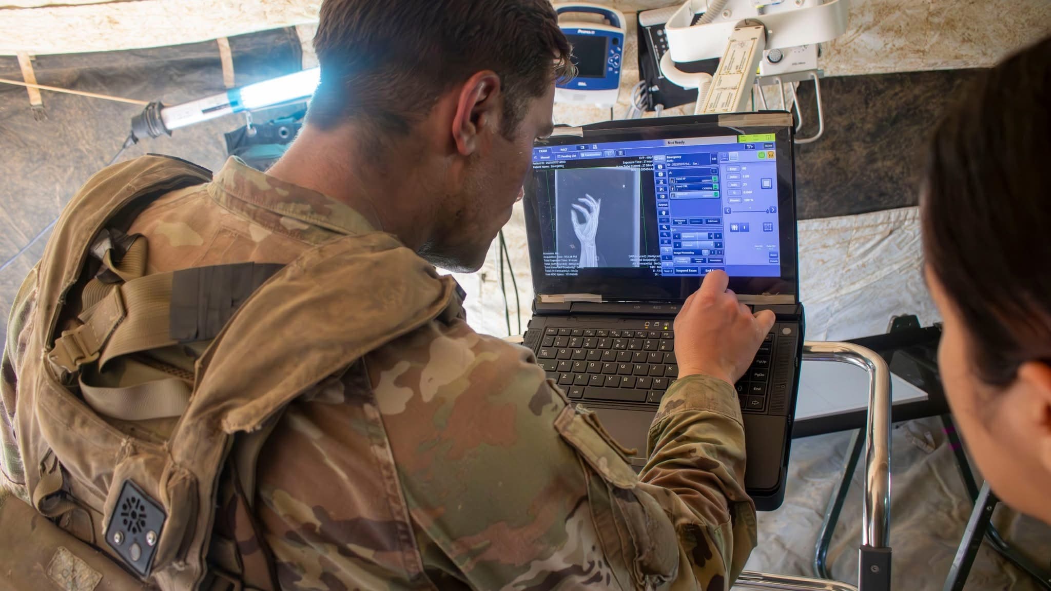Reviewing a hand radiograph on a field X-ray console